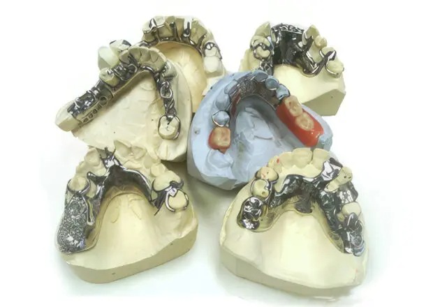 Prothèses partielles